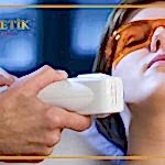 Soprano Lazer Epilasyon